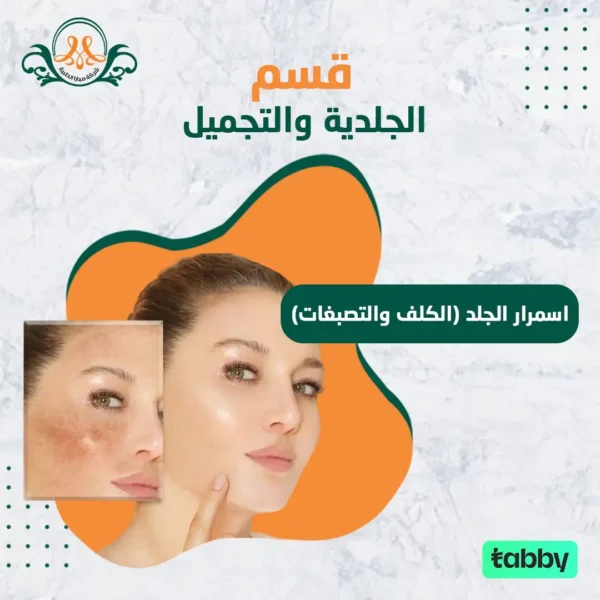 اسمرار الجلد (الكلف والتصبغات)