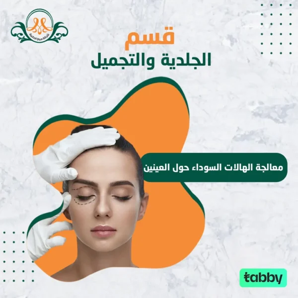 معالجة الهالات السوداء حول العينين.