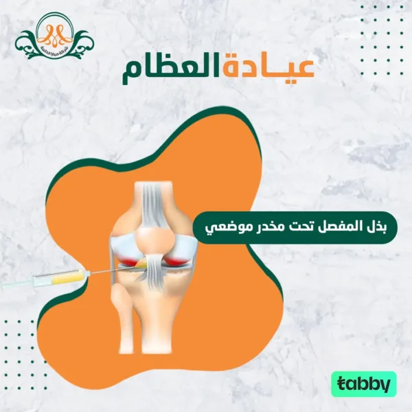 بذل المفصل تحت مخدر موضعي