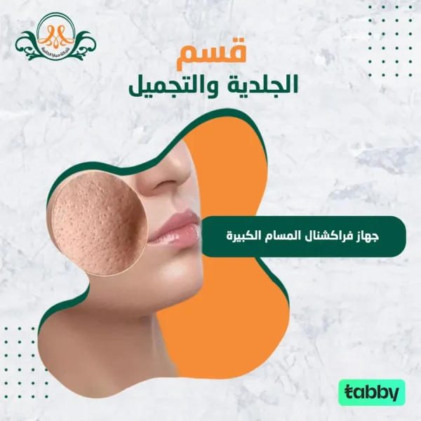 جهاز فراكشنال  المسام الكبيرة