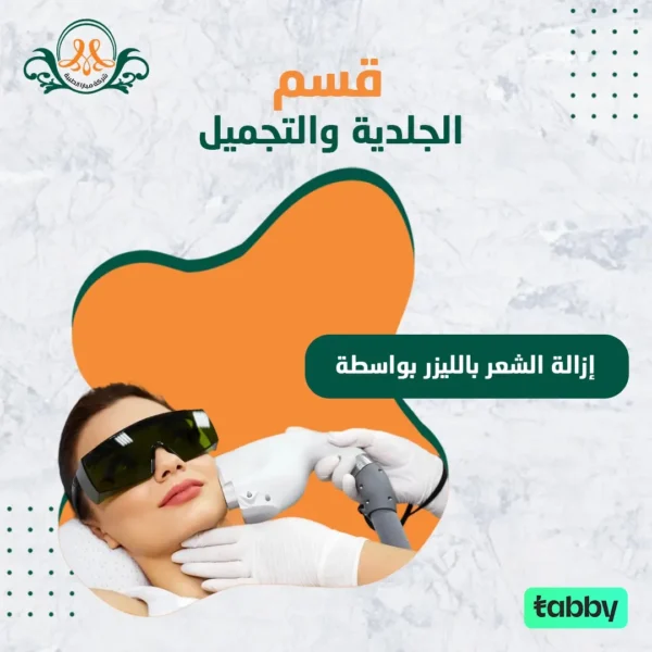 إزالة الشعر بالليزر بواسطة