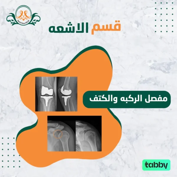 مفصل الركبه و الكتف
