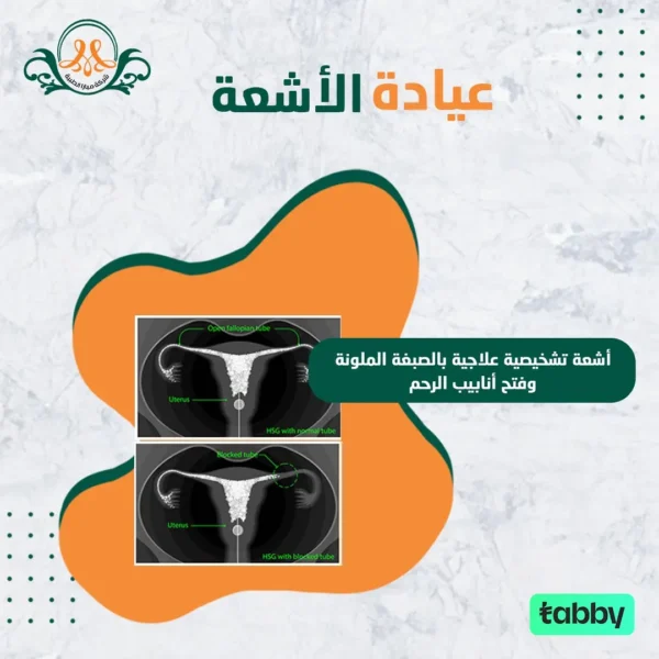 أشعة تشخيصية علاجية بالصبغة الملونة و فتح أنابيب الرحم