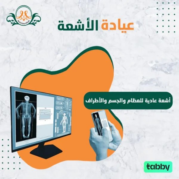 أشعة عادية للعظام و الجسم و الأطراف