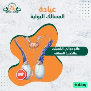 علاج دوالي الخصيتين والخصية المعلقه