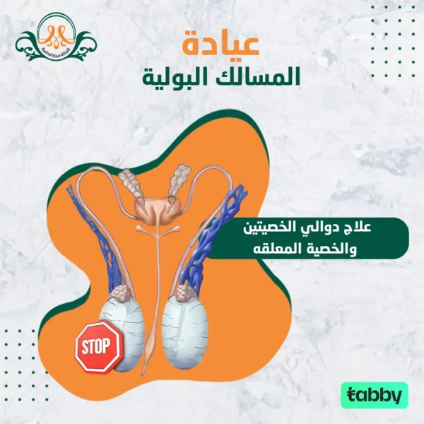 علاج دوالي الخصيتين والخصية المعلقه