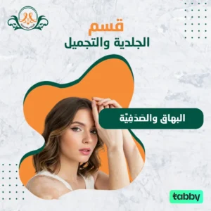 البهاق والصَدَفِيَّة