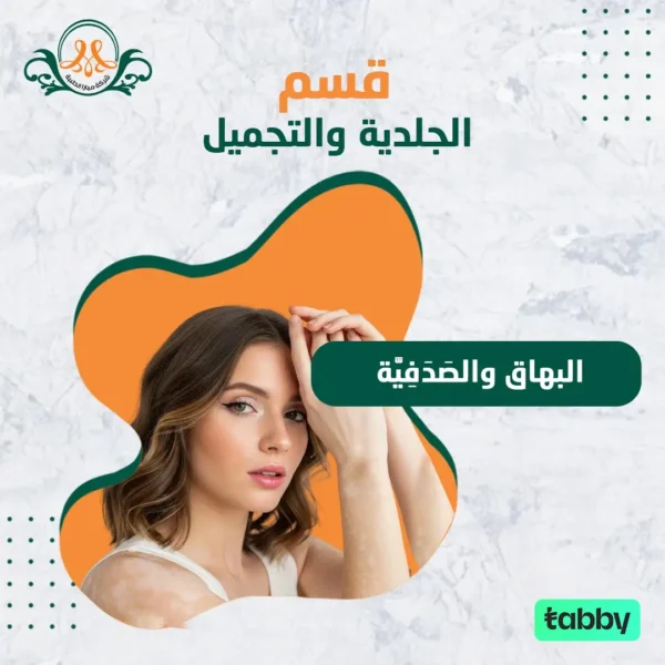 البهاق والصَدَفِيَّة