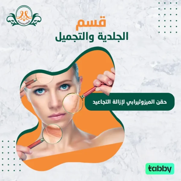 حقن الميزوثيرابي لإزالة التجاعيد