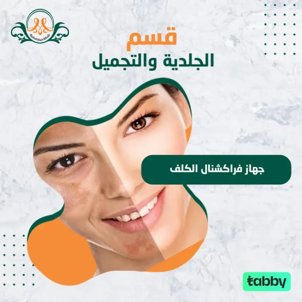 جهاز فراكشنال الكلف