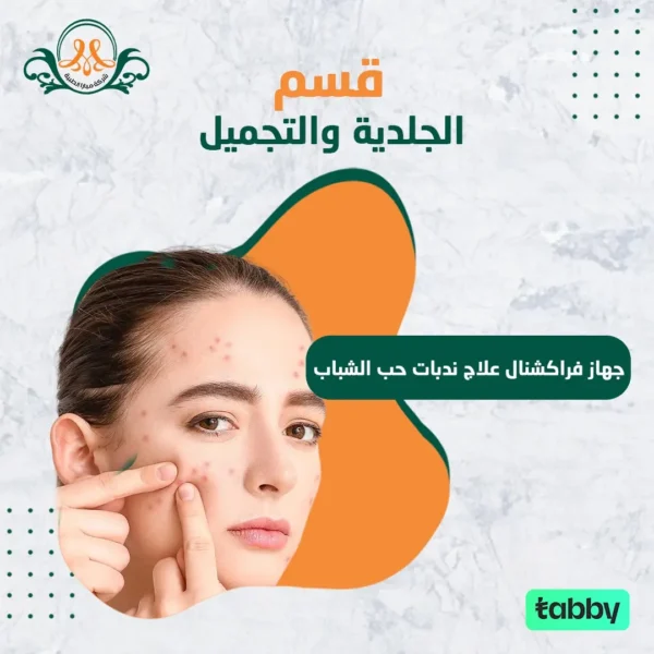 جهاز فراكشنال علاج ندبات حب الشباب