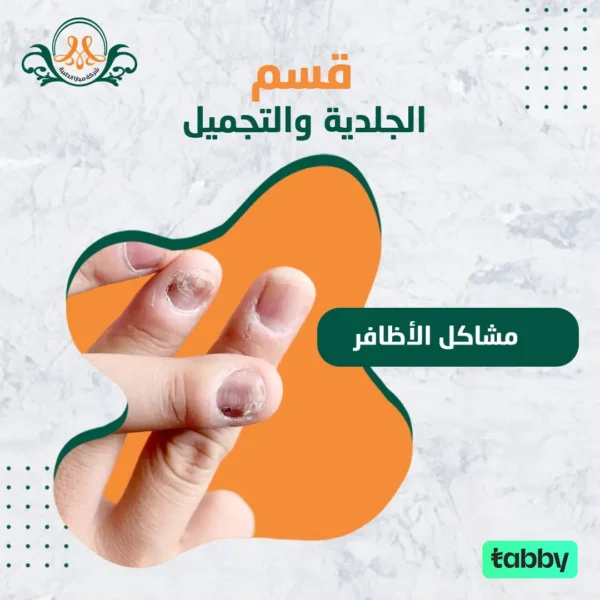 مشاكل الأظافر