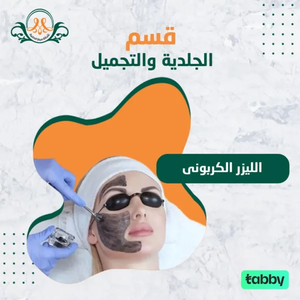الليزر الكربونى