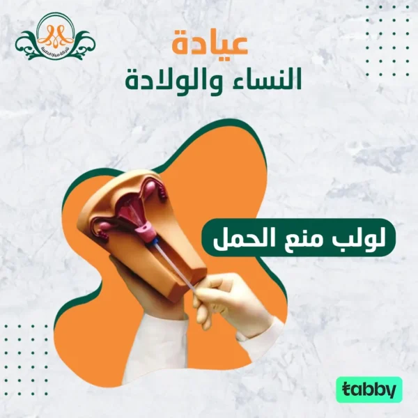 لولب منع الحمل