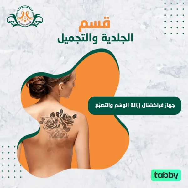 جهاز فراكشنال إزالة الوشم و التصبّغ