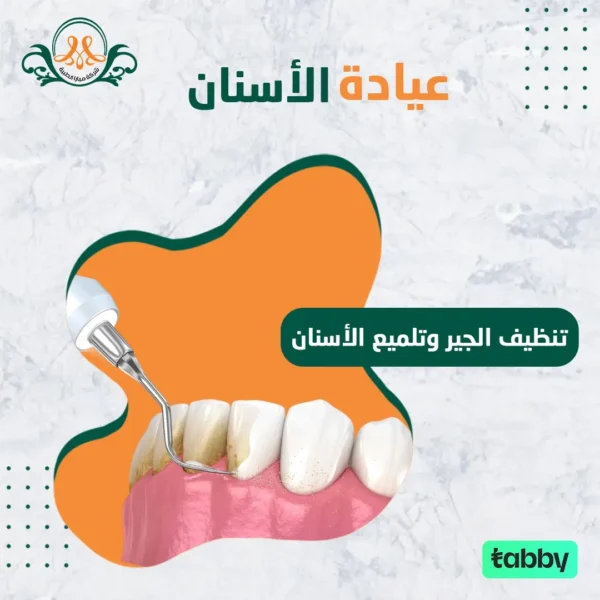 تنظيف الجير و تلميع الأسنان