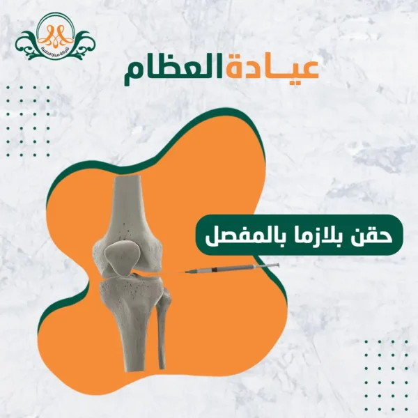 حقن بلازما بالمفصل