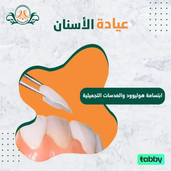 ابتسامة هوليوود و عدسات تجميلية