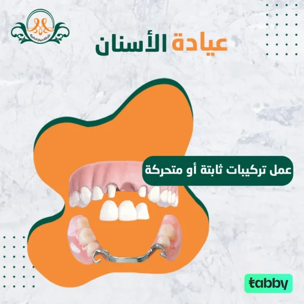 عمل تركيبات ثابتة أو متحركة
