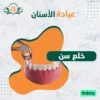 خلع سن