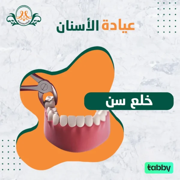 خلع سن
