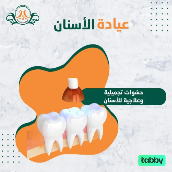 حشوات تجميلية وعلاجية للأسنان