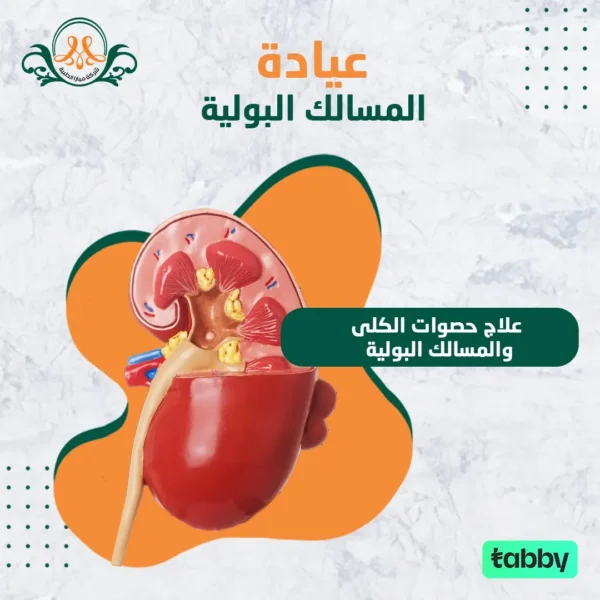 علاج حصوات الكلى والمسالك البولية