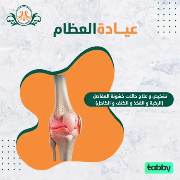 تشخيص و علاج حالات خشونة المفاصل (الركبة و الفخذ و الكتف و الكاحل